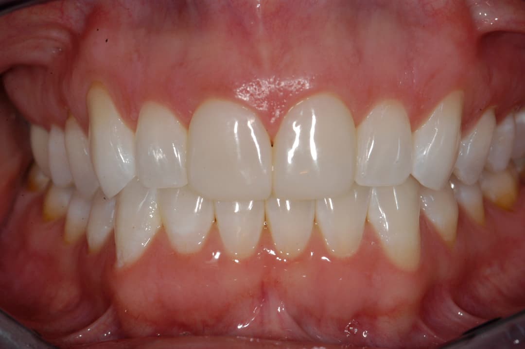 Transformation 6