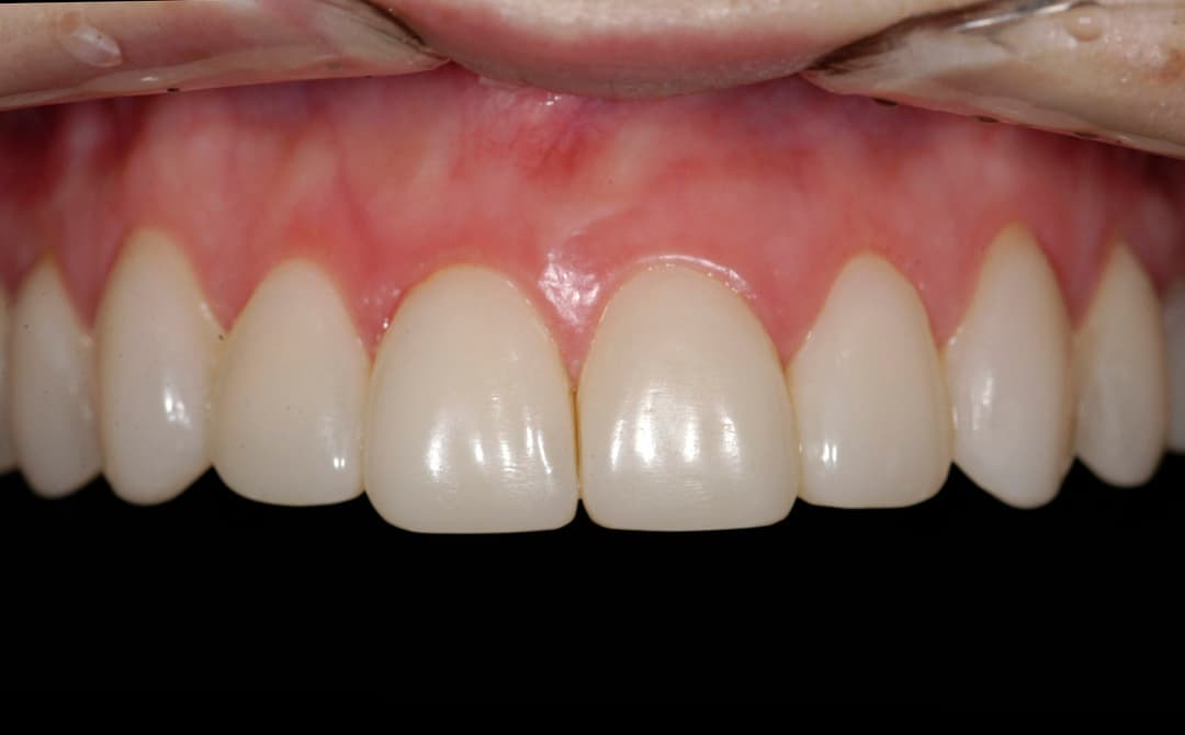Transformation 8