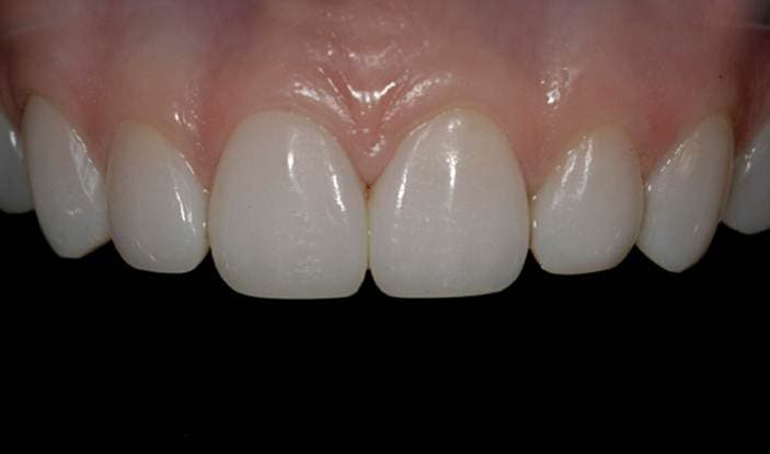 Transformation 12