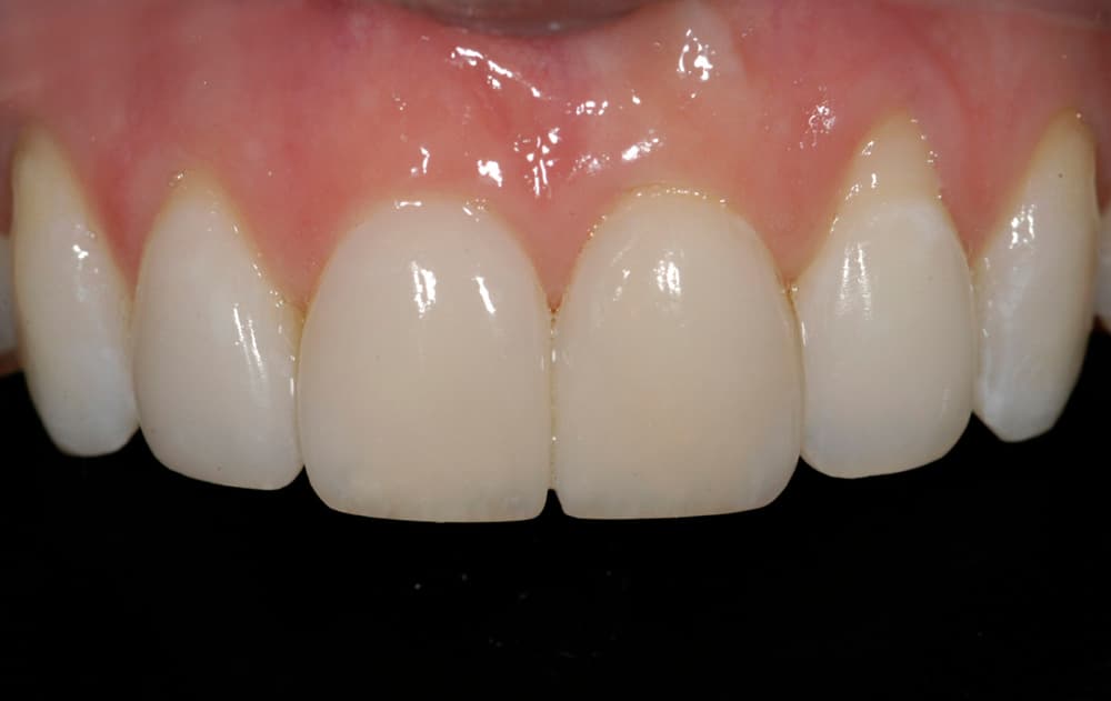 Transformation 14