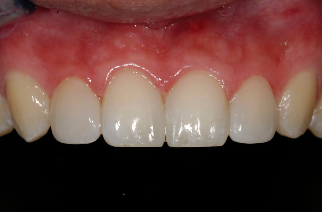 Transformation 16