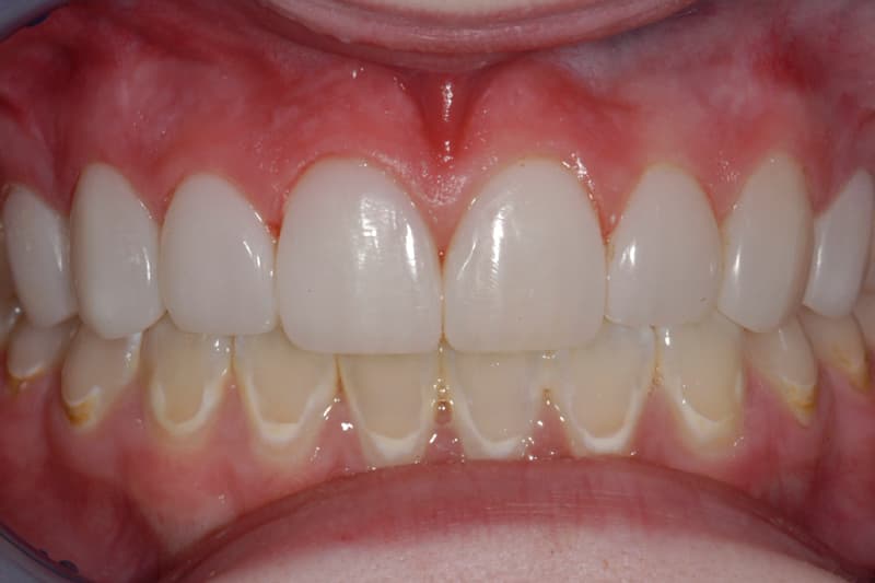 Transformation 18