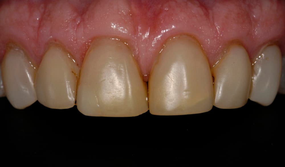 Transformation 1