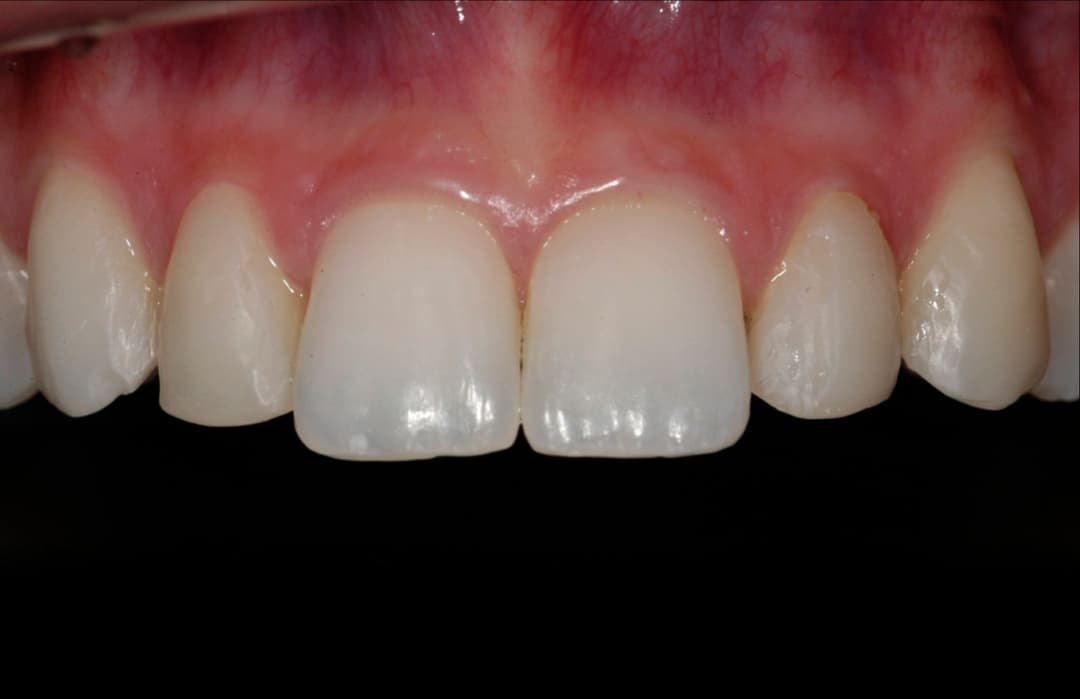 Transformation 19