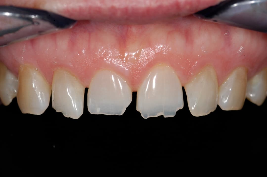 Transformation 3