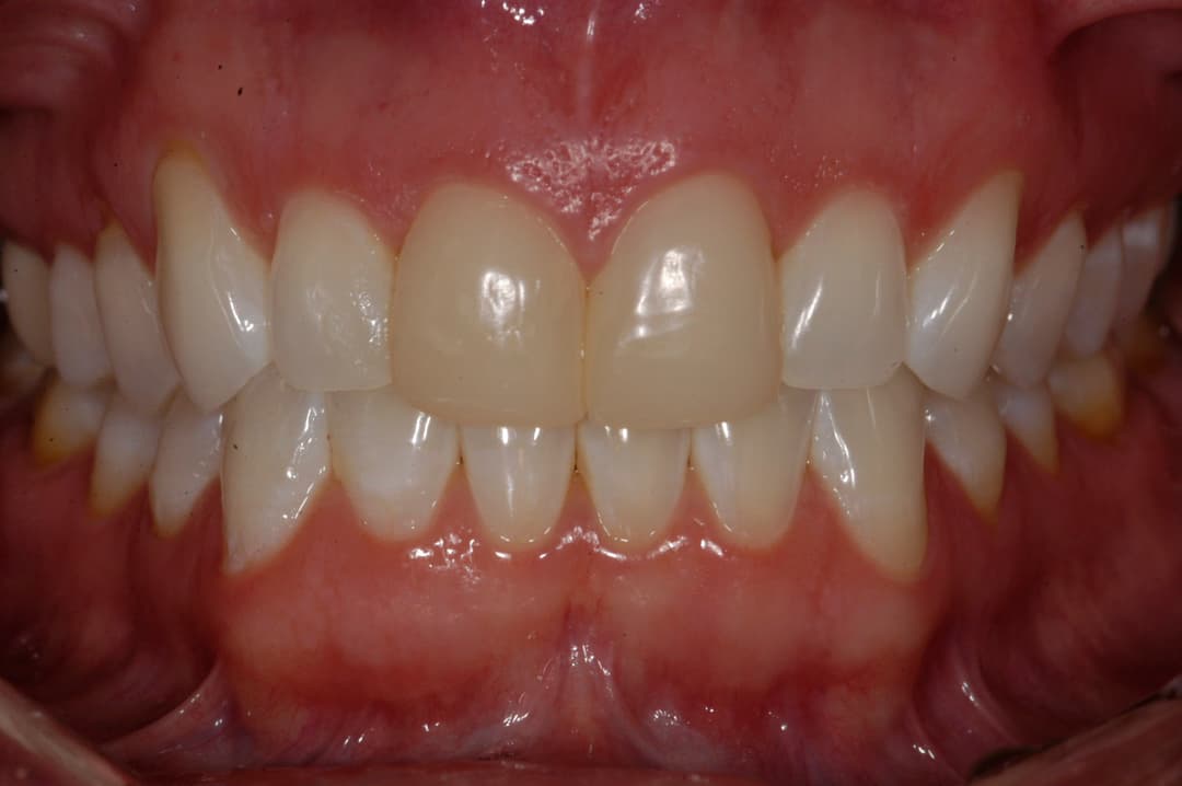 Transformation 5