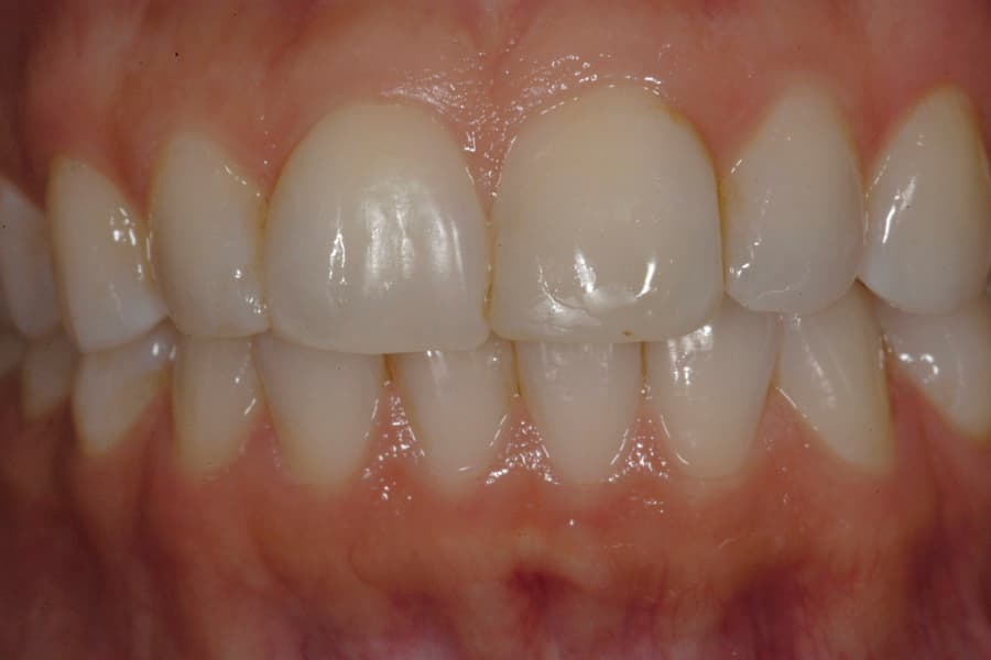 Transformation 9