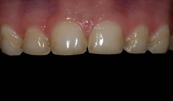 Transformation 11