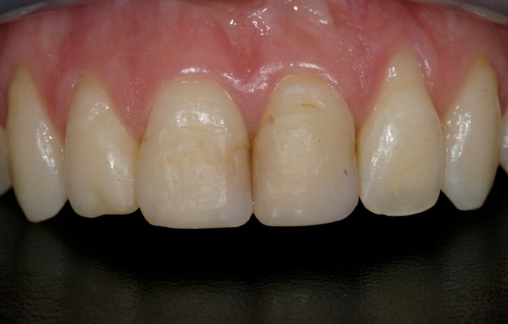 Transformation 13