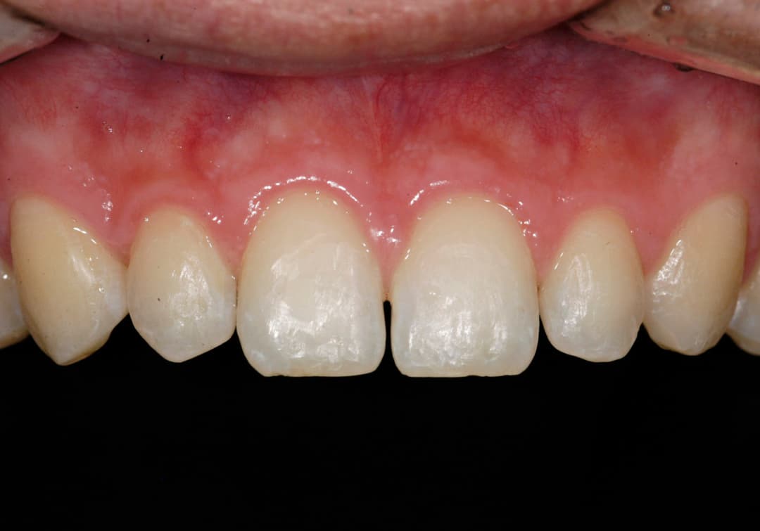Transformation 15
