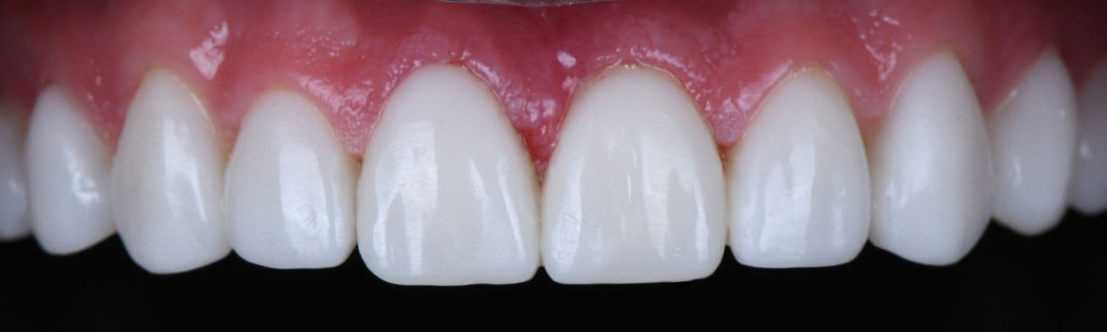Dental examination in progress